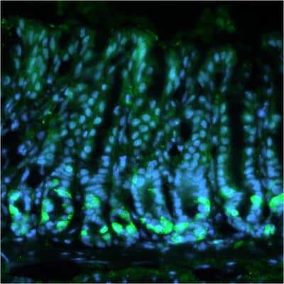 Immunohistochemistry: Calcium-sensing R/CaSR Antibody (5C10, ADD) - BSA Free [NB120-19347]
