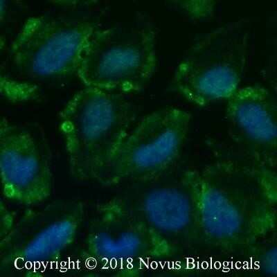 Immunocytochemistry/ Immunofluorescence: Calcium-sensing R/CaSR Antibody (HL 1499) - Azide and BSA Free [NBP2-80607]