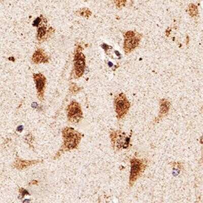 Immunohistochemistry-Paraffin: Calcium-sensing R/CaSR Antibody (HL 1499) - Azide and BSA Free [NBP2-80607]