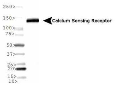 Western Blot: Calcium-sensing R/CaSR Antibody (HL 1499)Azide and BSA Free [NBP2-80607]