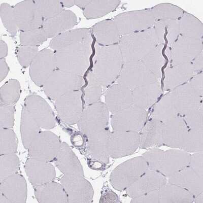 Immunohistochemistry-Paraffin: Calcium-sensing R/CaSR Antibody [NBP1-84687]