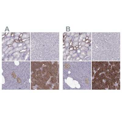 Immunohistochemistry-Paraffin: Calcium-sensing R/CaSR Antibody [NBP1-84687]