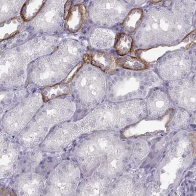 Immunohistochemistry-Paraffin: Calcium-sensing R/CaSR Antibody [NBP1-84687]