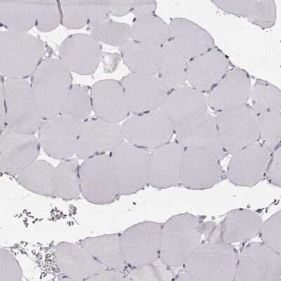 Immunohistochemistry-Paraffin: Calcium-sensing R/CaSR Antibody [NBP1-84687]