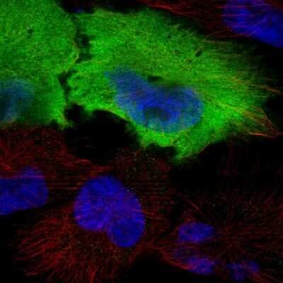 Immunocytochemistry/ Immunofluorescence: Calcyphosine Antibody [NBP1-91746]