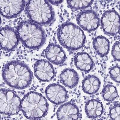 Immunohistochemistry-Paraffin: Calcyphosine Antibody [NBP1-91746]