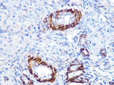 Immunohistochemistry-Paraffin: Caldesmon/CALD1 Antibody (6M5Q9) [NBP3-16499]