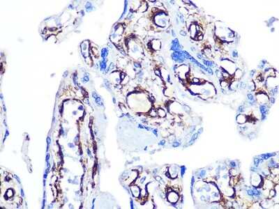 Immunohistochemistry-Paraffin: Caldesmon/CALD1 Antibody (6M5Q9) [NBP3-16499]