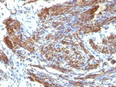 Immunohistochemistry-Paraffin: Caldesmon/CALD1 Antibody (CALD1/820) - Azide and BSA Free [NBP2-47818]