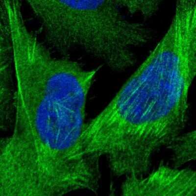 Immunocytochemistry/ Immunofluorescence: Caldesmon/CALD1 Antibody [NBP1-85702]