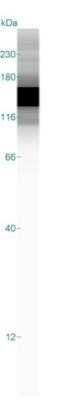 Simple Western: Caldesmon/CALD1 Antibody (h-CALD)Azide and BSA Free [NBP2-47816]