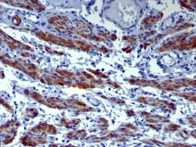 Immunohistochemistry-Paraffin: Caldesmon/CALD1 Antibody (h-CALD) [NBP2-44421]