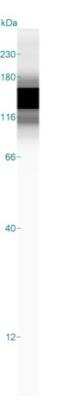 Simple Western: Caldesmon/CALD1 Antibody (h-CALD) [NBP2-44421]