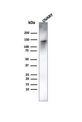 Western Blot: Caldesmon/CALD1 Antibody (rCALD1/820)Azide and BSA Free [NBP3-08326]