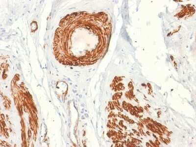 Immunohistochemistry-Paraffin: Caldesmon/CALD1 Antibody (rCALD1/820) [NBP3-07367]