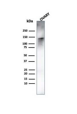 Western Blot: Caldesmon/CALD1 Antibody (rCALD1/820) [NBP3-07367]