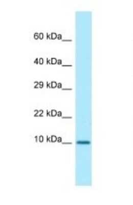 Western Blot: Calmodulin 3 Antibody [NBP1-98474]