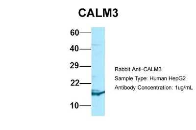 Western Blot: Calmodulin 3 Antibody [NBP1-98474]