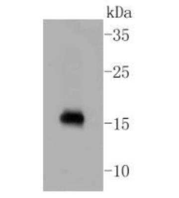 Western Blot: Calmodulin Antibody (SJ16-09) [NBP2-67413]
