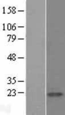 Western Blot: Calmodulin Overexpression Lysate [NBL1-08649]