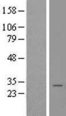 Western Blot: Calneuron 1 Overexpression Lysate [NBL1-08654]