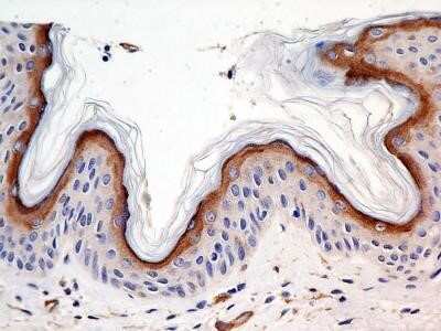 Immunohistochemistry: Calnexin Antibody (1C2.2D11) - Azide and BSA Free [NBP2-80608]
