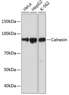Western Blot: Calnexin Antibody (5S3U3) [NBP3-16490]