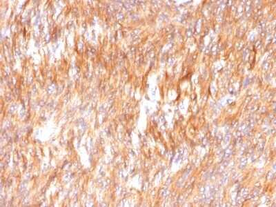 Immunohistochemistry-Paraffin: Calnexin Antibody (CANX/1541) - Azide and BSA Free [NBP2-54552]