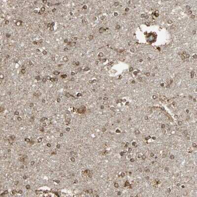 Immunohistochemistry-Paraffin: Calnexin Antibody [NBP1-85519]