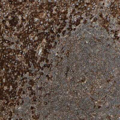 Immunohistochemistry-Paraffin: Calnexin Antibody [NBP1-85520]