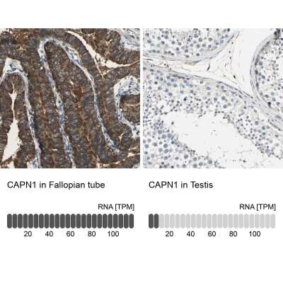 Immunohistochemistry-Paraffin: Calpain 1 Antibody [NBP1-88205]