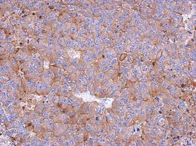 Immunohistochemistry-Paraffin: Calpain 1 Antibody [NBP2-15670]