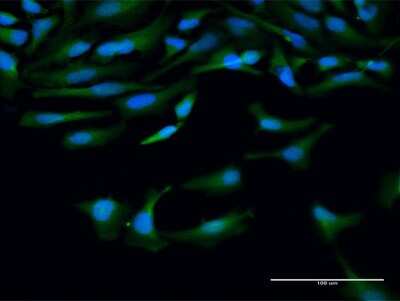 Immunocytochemistry/ Immunofluorescence: Calpain 10 Antibody [H00011132-D01P]