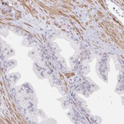 Immunohistochemistry-Paraffin: Calpain 11 Antibody [NBP2-33942]