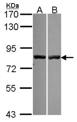 Western Blot: Calpain 11 Antibody [NBP2-15673]