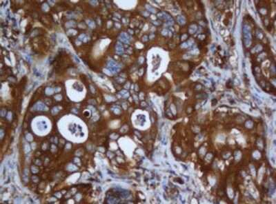 Immunohistochemistry: Calpain 2 Antibody (OTI3G1) [NBP2-46063]