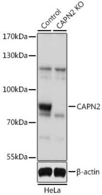 Knockout Validated: Calpain 2 Antibody - BSA Free [NBP2-92949]
