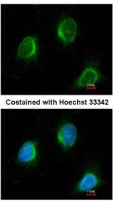 Immunocytochemistry/ Immunofluorescence: Calpain 3 Antibody [NBP1-31756]