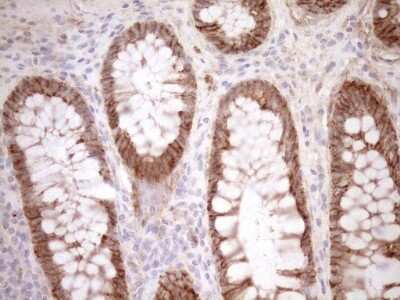Immunohistochemistry: Calpain 5 Antibody (OTI7D2) [NBP2-46064]