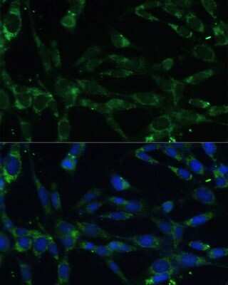 Immunocytochemistry/ Immunofluorescence: Calpain 5 Antibody - BSA Free [NBP2-92674]