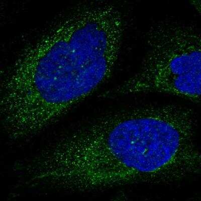 Immunocytochemistry/ Immunofluorescence: Calpain 6 Antibody [NBP1-88214]