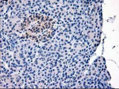 Immunohistochemistry-Paraffin: Calpain 9 Antibody (OTI3G10) [NBP2-01305]
