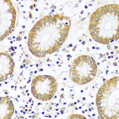 Immunohistochemistry-Paraffin: Calpain 9 Antibody - Azide and BSA Free [NBP3-03707]