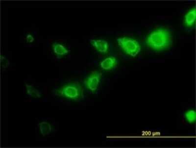 Immunocytochemistry/ Immunofluorescence: Calpain S1 Antibody (3C4) [H00000826-M01]