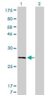 Western Blot: Calpain S1 Antibody (3C4) [H00000826-M01]