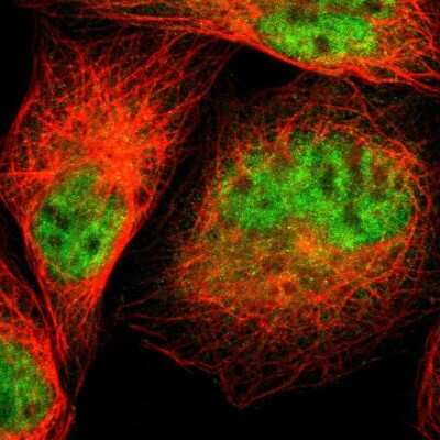 Immunocytochemistry/ Immunofluorescence: Calpain S1 Antibody [NBP1-90329]