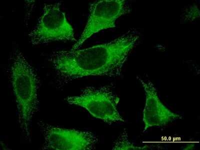 Immunocytochemistry/ Immunofluorescence: Calpastatin Antibody (2C5) [H00000831-M03]