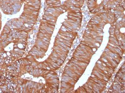 Immunohistochemistry-Paraffin: Calpastatin Antibody (CAST/1550) - Azide and BSA Free [NBP3-08510]