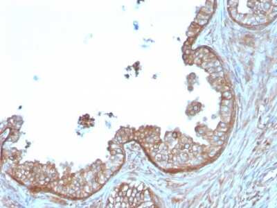 Immunohistochemistry-Paraffin: Calpastatin Antibody (CAST/1550) - Azide and BSA Free [NBP3-08510]