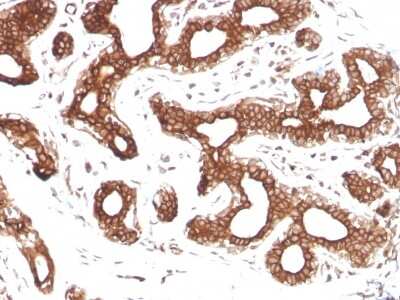 Immunohistochemistry-Paraffin: Calpastatin Antibody (CAST/1550) [NBP3-07397]